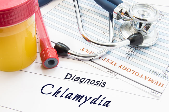 Document diagnosing Chlamydia