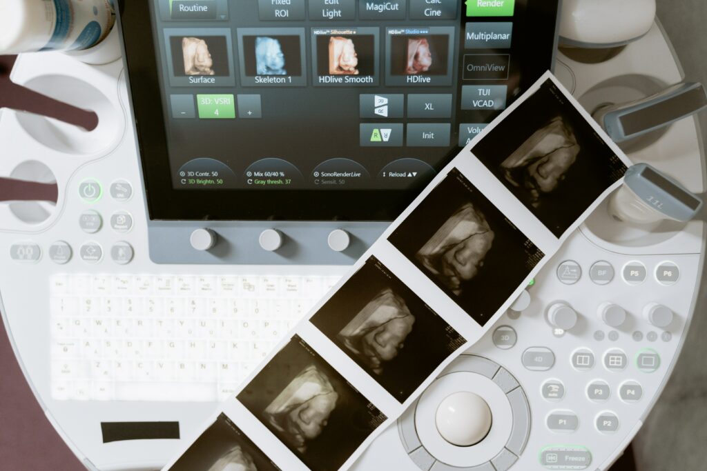 Ultrasound pictures from free pregnancy ultrasounds offered in Florida